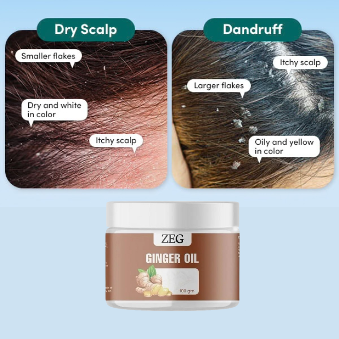 100% Dandruff Removal ZEG GINGER OIL Natural Multipurpose Oil !